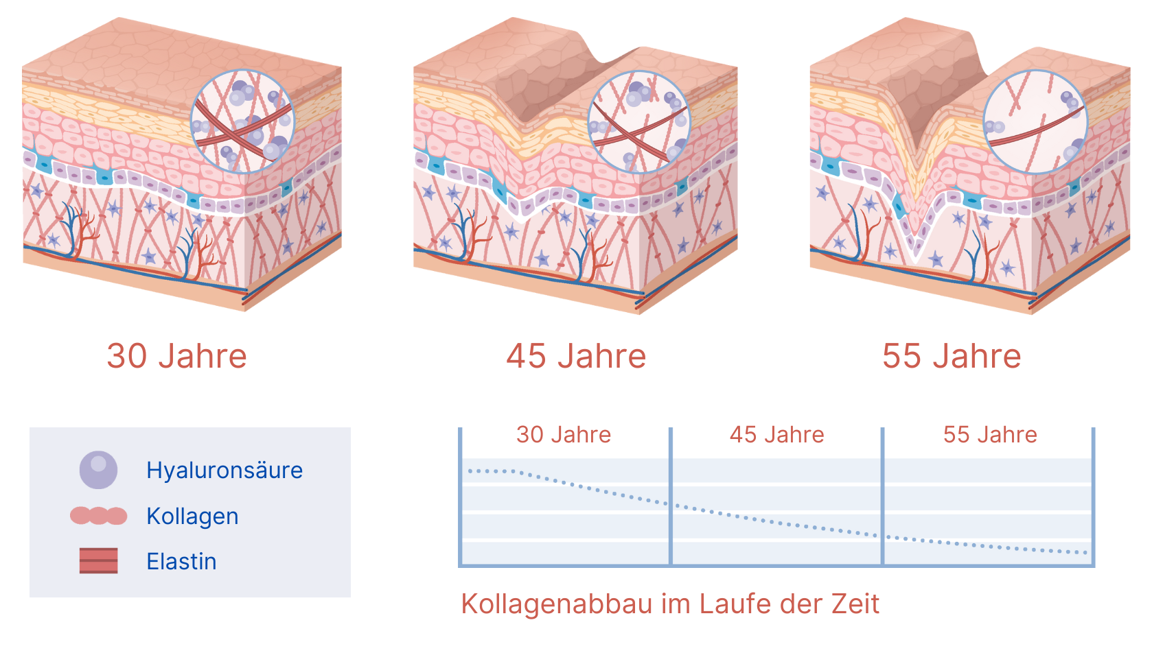 Kollagenabbau im Alter