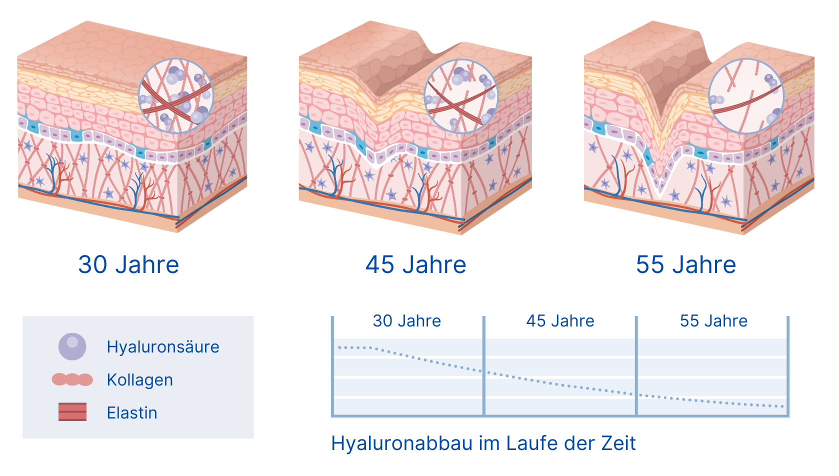 30 Jahre Hautalterung