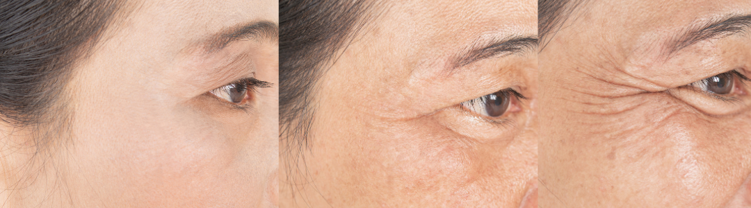 Hautalterung im Laufe der Zeit