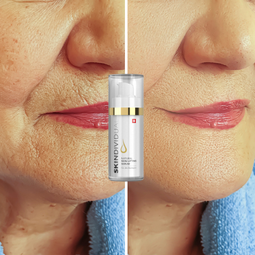 Vorher-Nachher Resultate