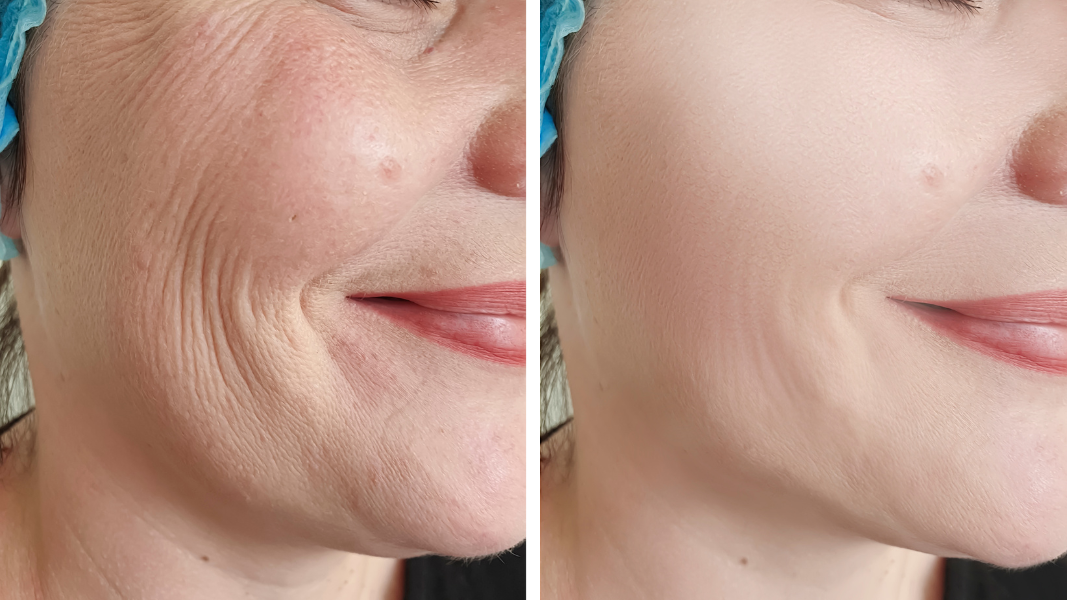 Natural Skin Lifting Serum von SKINDIVIDUAL